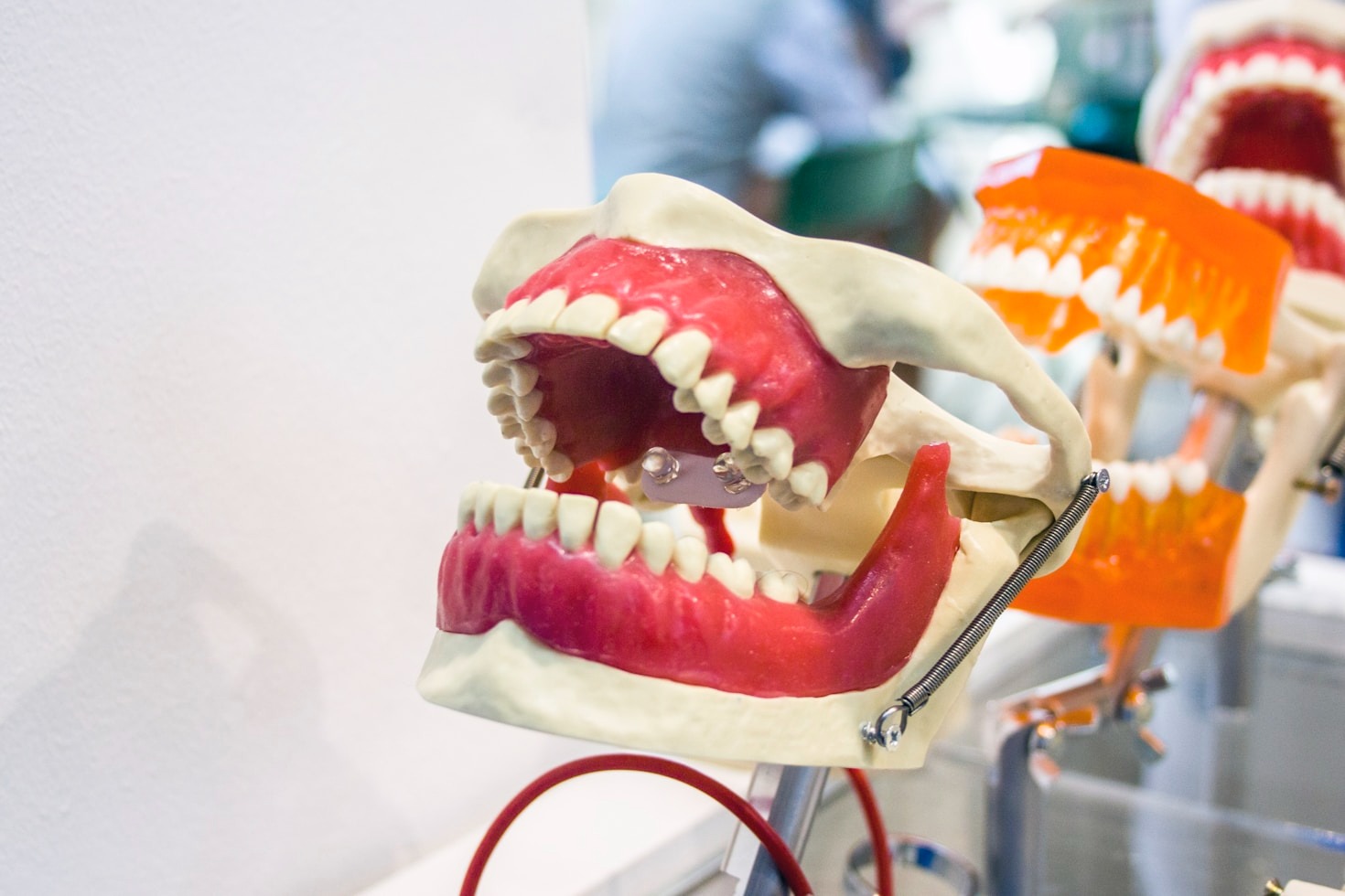 Top Benefits of Using CAD/CAM for Dental Restorations